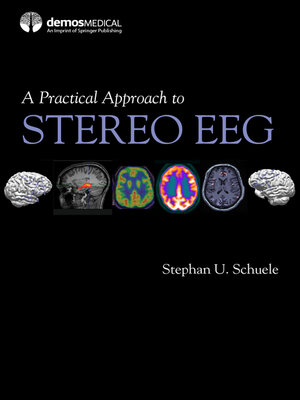 cover image of A Practical Approach to Stereo EEG